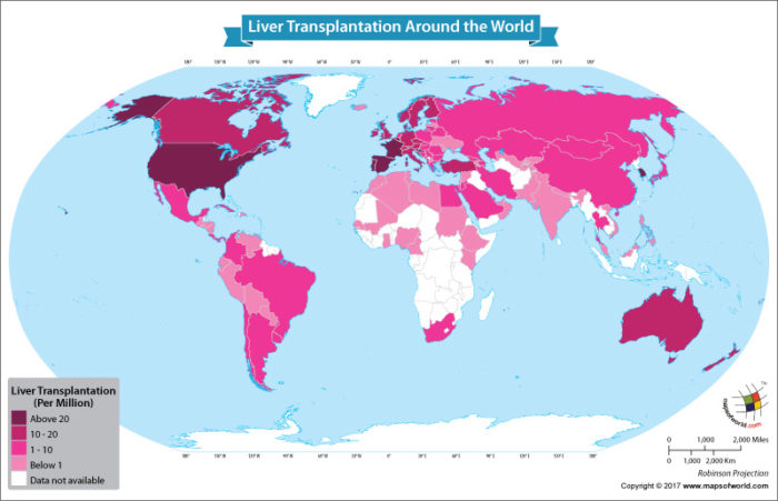 World map showing liver transplantations around the world